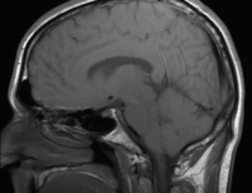 Brain Power still important